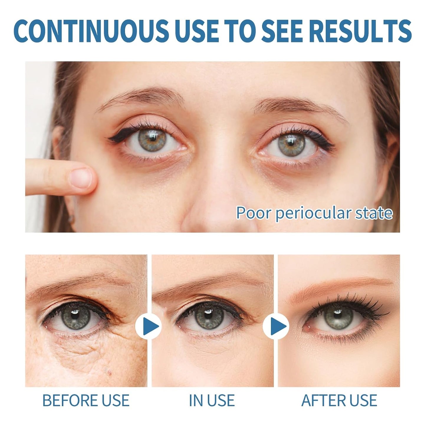 Parches para Ojos - additional image 5