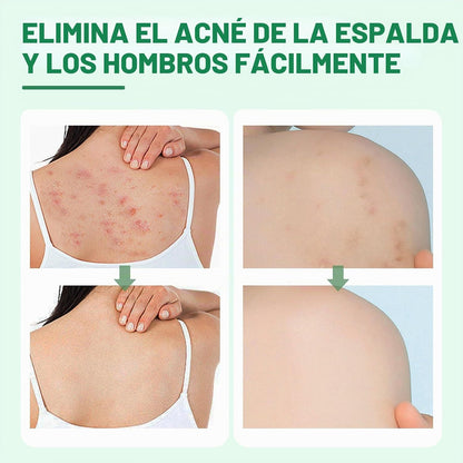 Spray de granos para el cuerpo - additional image 3