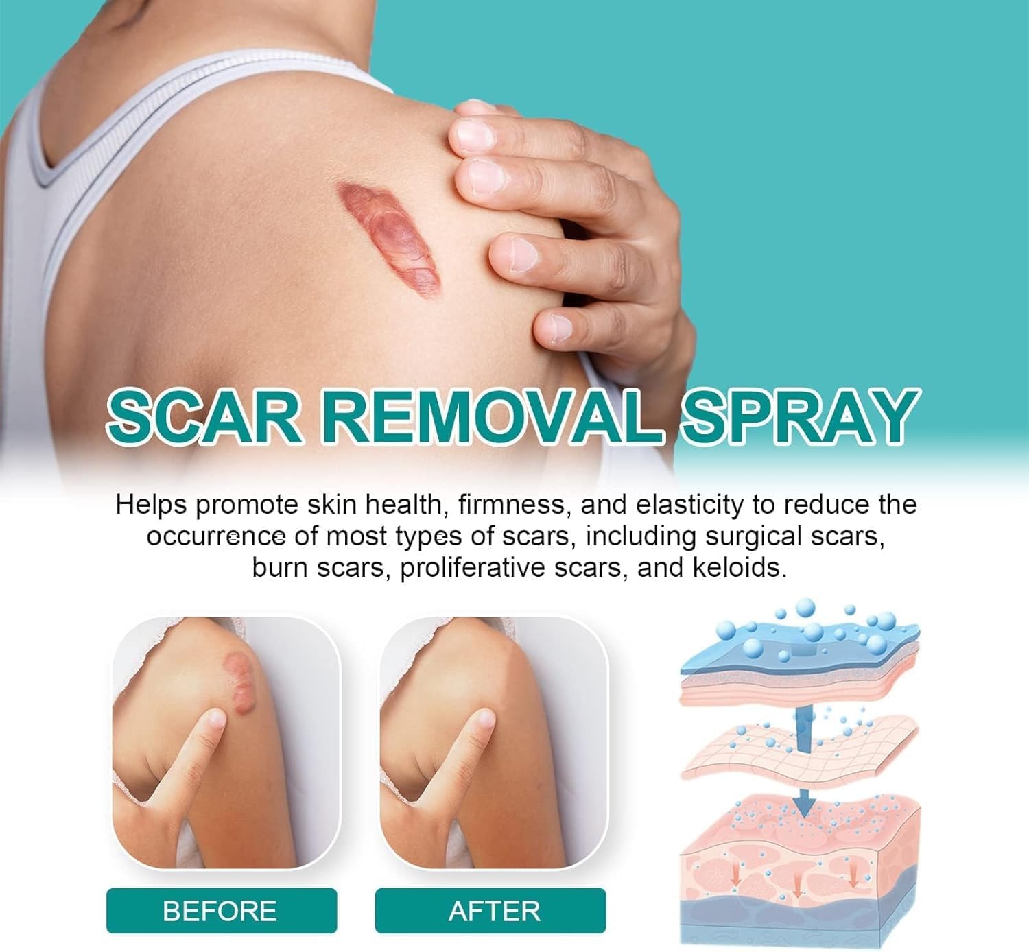 Spray para cicatrices - additional image 4